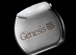 Imagen: el dispositivo de neuroestimulación Genesis (Foto cortesía de St. Jude Medical).